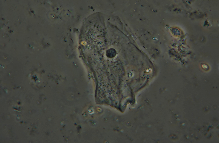 MISSIONE COMPIUTA !! - MICROSCOPIO ACQUISTATO